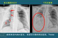 肺扭转：一种你可能不知道的疾病，连藏獒都可能中招